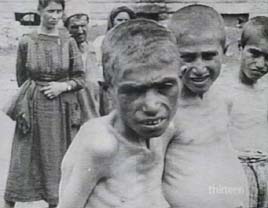 Armenian famine victim. The famine affected all.